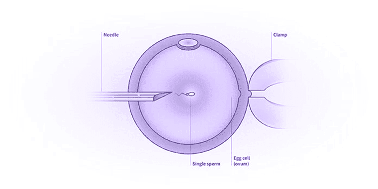 Tinjauan Perawatan Fertilitas