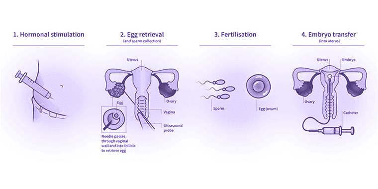 Tinjauan Perawatan Fertilitas